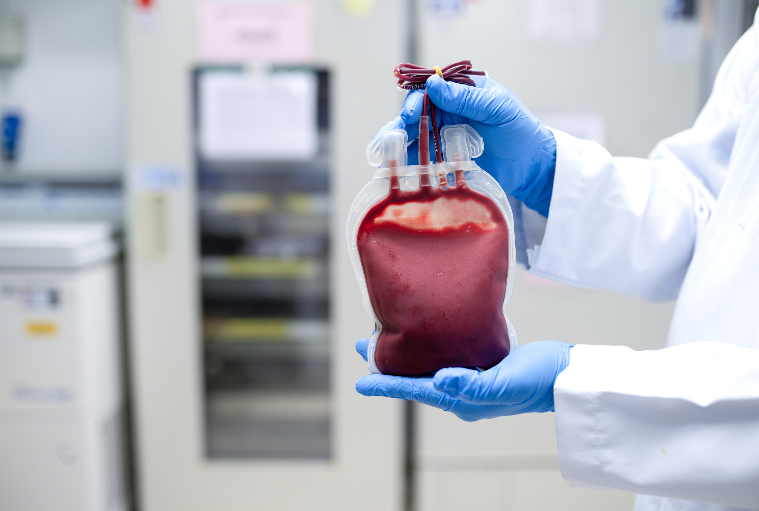 vecteezy doctor s hand holding blood bag in laboratory technician 24263308 scaled