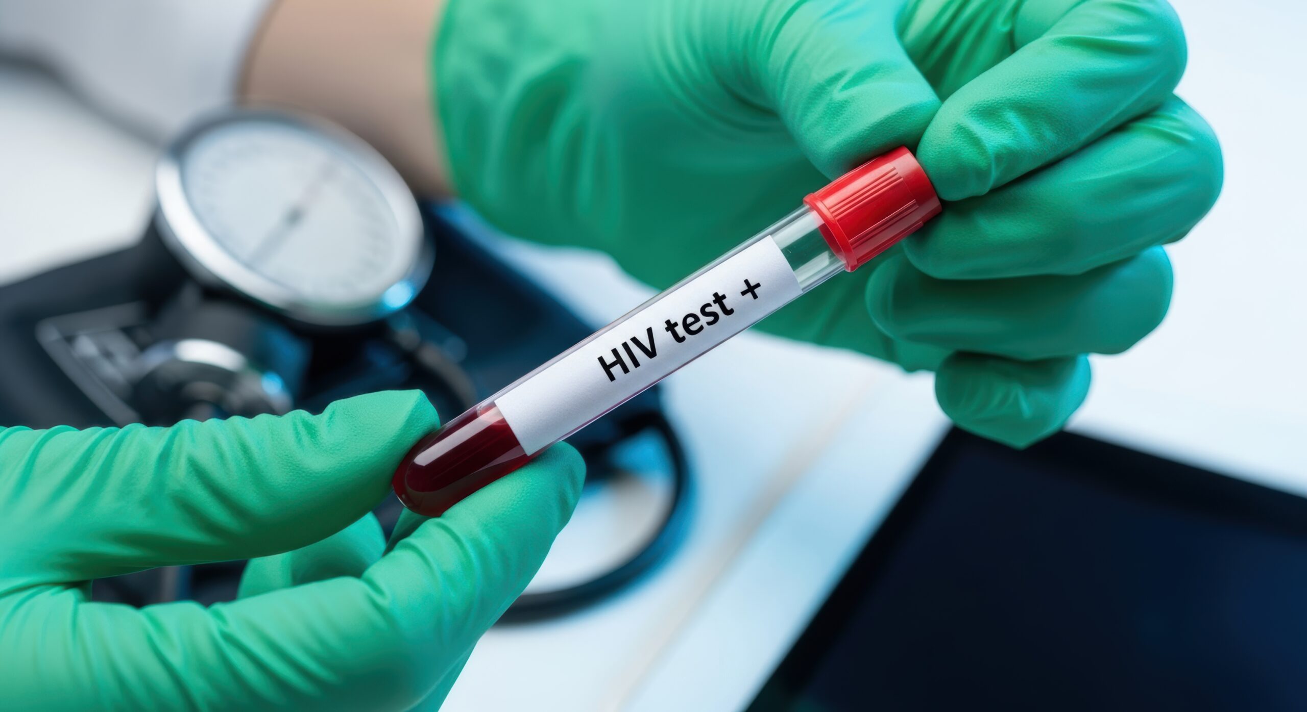 vecteezy gloved hands holding a test tube with a positive hiv blood 6724302 1 scaled