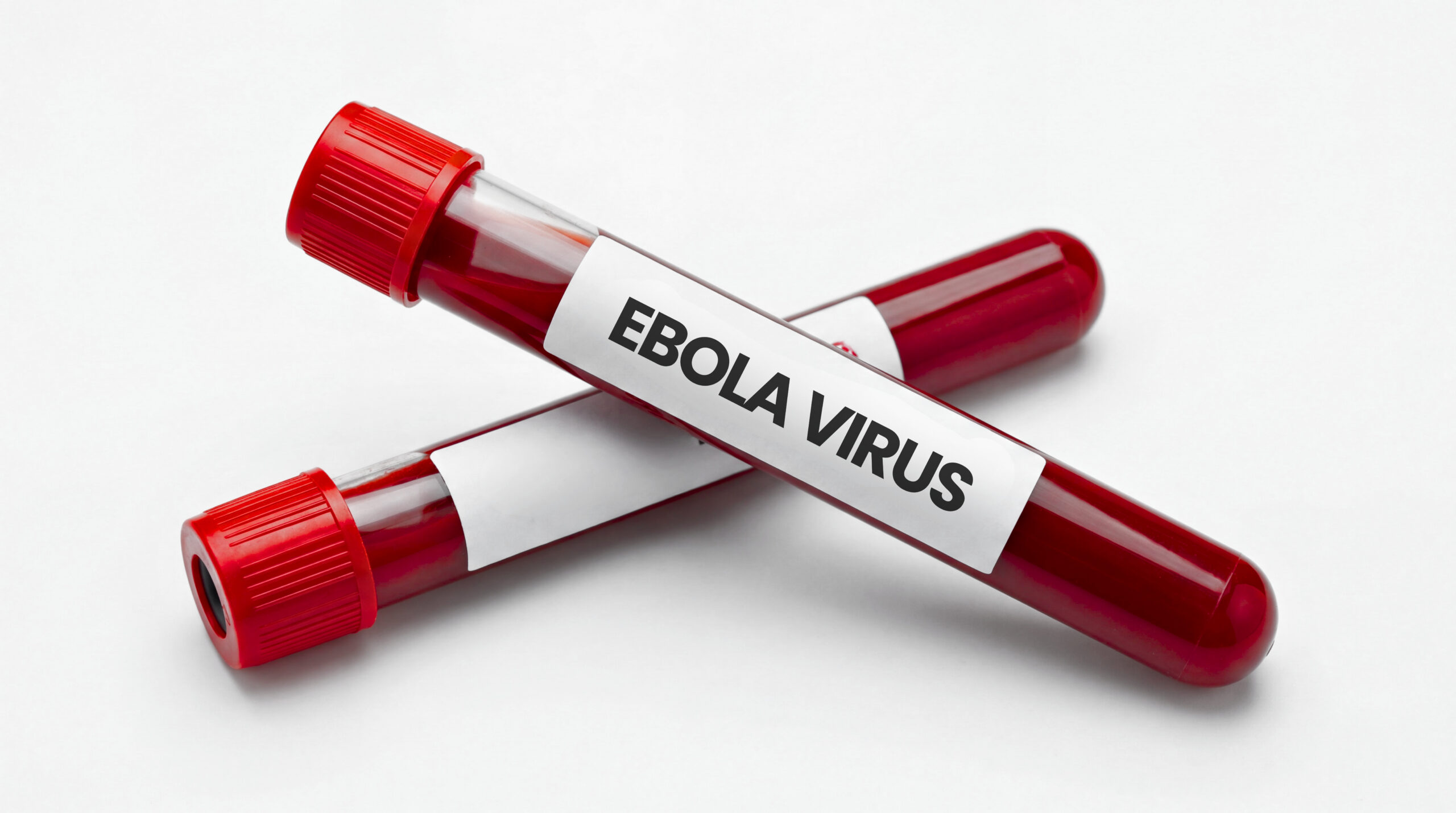 vecteezy two medical test tubes with ebola virus blood samples 82324723 scaled